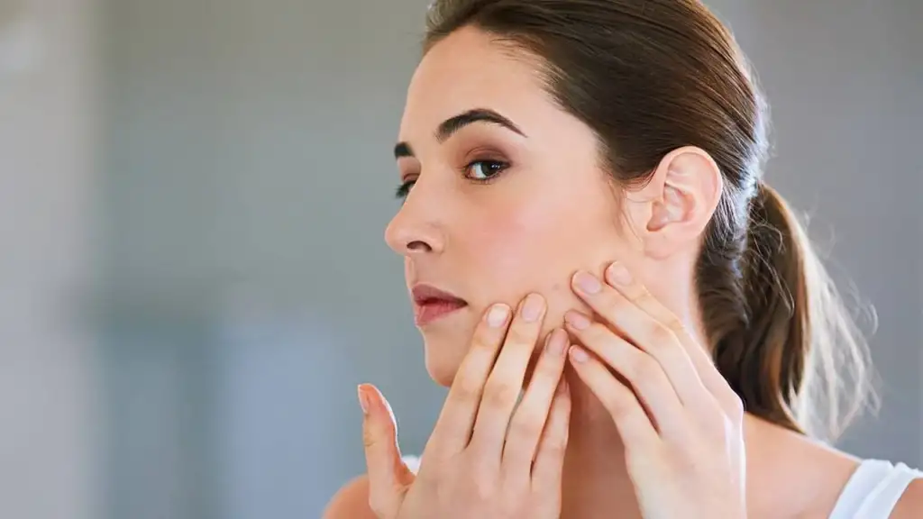 Studio Psiché Milano - Acne, il disagio sul corpo